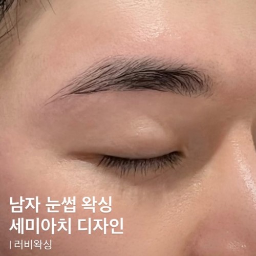 [ 러비왁싱 ] 시술사진 1