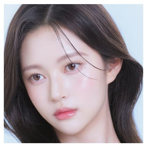[ 린트아이 ] 시술사진 2